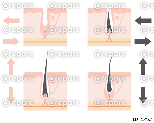 毛が生える仕組みの断面図と矢印のイラストセット